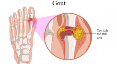 benh-gout
